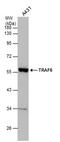 TNF Receptor Associated Factor 6 antibody, PA5-29622, Invitrogen Antibodies, Western Blot image 