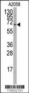 RAR Related Orphan Receptor A antibody, 55-471, ProSci, Western Blot image 