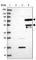 Heparanase 2 (Inactive) antibody, HPA044603, Atlas Antibodies, Western Blot image 