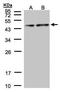 Pyruvate Dehydrogenase E1 Alpha 1 Subunit antibody, PA5-21536, Invitrogen Antibodies, Western Blot image 