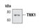 Non-receptor tyrosine-protein kinase TNK1 antibody, MA5-14860, Invitrogen Antibodies, Western Blot image 