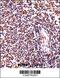 Hematopoietic Cell-Specific Lyn Substrate 1 antibody, 57-433, ProSci, Immunohistochemistry frozen image 