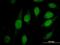 ATRX Chromatin Remodeler antibody, MA5-18469, Invitrogen Antibodies, Immunofluorescence image 