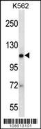 Argonaute RISC Catalytic Component 2 antibody, MBS9213639, MyBioSource, Western Blot image 