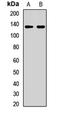 Scaffold Attachment Factor B2 antibody, LS-C668986, Lifespan Biosciences, Western Blot image 
