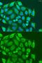 Metaxin-1 antibody, GTX32719, GeneTex, Immunofluorescence image 