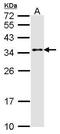 Mediator Complex Subunit 7 antibody, PA5-28841, Invitrogen Antibodies, Western Blot image 