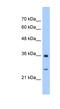 Glutathione S-Transferase Zeta 1 antibody, NBP1-55137, Novus Biologicals, Western Blot image 