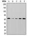 Serine/Threonine Kinase 38 antibody, abx142250, Abbexa, Western Blot image 