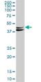 Dematin antibody, H00002039-B01P, Novus Biologicals, Western Blot image 