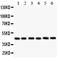 CD25 antibody, PA1747, Boster Biological Technology, Western Blot image 