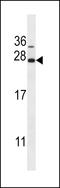 Cancer/Testis Antigen 1B antibody, LS-C167114, Lifespan Biosciences, Western Blot image 