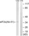 Eukaryotic Translation Initiation Factor 2 Subunit Alpha antibody, LS-B7198, Lifespan Biosciences, Western Blot image 