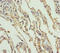 Sodium-dependent phosphate transport protein 2A antibody, orb40889, Biorbyt, Immunohistochemistry paraffin image 