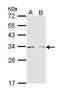 Arginase 1 antibody, PA5-29645, Invitrogen Antibodies, Western Blot image 