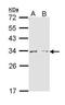 Arginase 1 antibody, PA5-29645, Invitrogen Antibodies, Western Blot image 