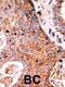 Lemur Tyrosine Kinase 2 antibody, PA5-13935, Invitrogen Antibodies, Immunohistochemistry frozen image 