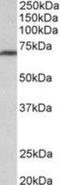 Methylenetetrahydrofolate Reductase antibody, NBP2-27549, Novus Biologicals, Western Blot image 