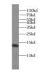 Sulfiredoxin 1 antibody, FNab08243, FineTest, Western Blot image 