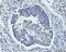 Prostaglandin E Synthase 2 antibody, A06706-2, Boster Biological Technology, Immunohistochemistry paraffin image 