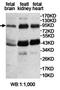 Tripartite Motif Containing 71 antibody, orb78195, Biorbyt, Western Blot image 