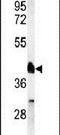 Retinoid X Receptor Alpha antibody, PA5-24845, Invitrogen Antibodies, Western Blot image 