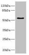 Calcitonin Receptor antibody, LS-C675453, Lifespan Biosciences, Western Blot image 