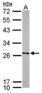 Ubiquitin Conjugating Enzyme E2 K antibody, GTX114469, GeneTex, Western Blot image 