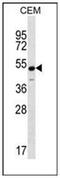 Potassium Voltage-Gated Channel Subfamily J Member 8 antibody, AP52312PU-N, Origene, Western Blot image 