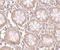 CD248 Molecule antibody, NBP1-77311, Novus Biologicals, Immunohistochemistry frozen image 