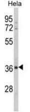 MyoD family inhibitor domain-containing protein antibody, GTX81076, GeneTex, Western Blot image 