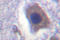 Acetyl-CoA Carboxylase Alpha antibody, LS-C176257, Lifespan Biosciences, Immunohistochemistry paraffin image 