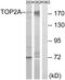DNA Topoisomerase II Alpha antibody, LS-C199673, Lifespan Biosciences, Western Blot image 