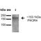 Phosphoinositide-3-Kinase Regulatory Subunit 4 antibody, LS-C775880, Lifespan Biosciences, Western Blot image 