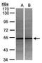 ADP Dependent Glucokinase antibody, GTX106029, GeneTex, Western Blot image 