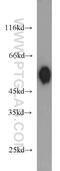 Delta Like Non-Canonical Notch Ligand 1 antibody, 10636-1-AP, Proteintech Group, Western Blot image 