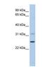 Dehydrogenase/Reductase 1 antibody, NBP1-56415, Novus Biologicals, Western Blot image 