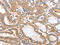 Acyl-CoA Thioesterase 11 antibody, CSB-PA908870, Cusabio, Immunohistochemistry paraffin image 