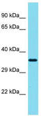 Siah E3 Ubiquitin Protein Ligase Family Member 3 antibody, TA334839, Origene, Western Blot image 