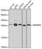 Sigma non-opioid intracellular receptor 1 antibody, A5479, ABclonal Technology, Western Blot image 