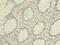 Heterogeneous Nuclear Ribonucleoprotein L antibody, CSB-PA010612LA01HU, Cusabio, Immunohistochemistry paraffin image 