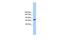 Transmembrane Channel Like 2 antibody, PA5-43535, Invitrogen Antibodies, Western Blot image 