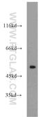 Protein Phosphatase 2 Regulatory Subunit B'Epsilon antibody, 23885-1-AP, Proteintech Group, Western Blot image 