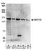 NUP155 antibody, A303-934A, Bethyl Labs, Western Blot image 