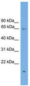 Zinc Finger Protein 320 antibody, TA339847, Origene, Western Blot image 