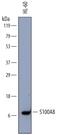 S100 Calcium Binding Protein A8 antibody, MAB4570, R&D Systems, Western Blot image 