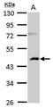 Casein Kinase 1 Alpha 1 antibody, PA5-28272, Invitrogen Antibodies, Western Blot image 