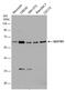 Sequestosome 1 antibody, PA5-78268, Invitrogen Antibodies, Western Blot image 