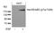 Erb-B2 Receptor Tyrosine Kinase 3 antibody, PA5-37566, Invitrogen Antibodies, Western Blot image 