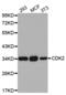 Cyclin Dependent Kinase 2 antibody, abx004232, Abbexa, Western Blot image 